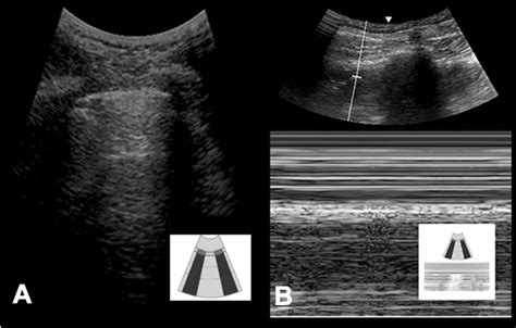 gucci diagnosis|Global Ultrasound Check for the Critically lll (GUCCI)—a new .